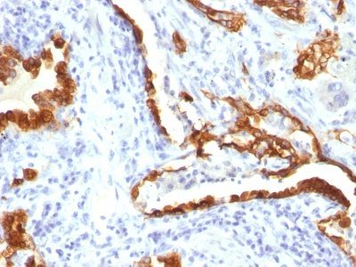 Cytokeratin 18 Monoclonal Mouse Antibody (KRT18/834)