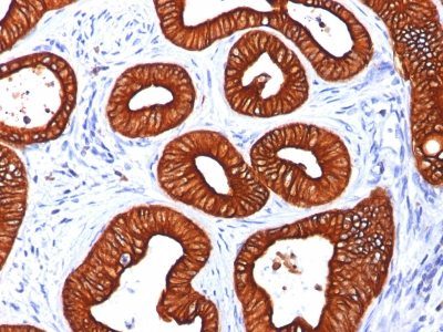 Cytokeratin 18 Monoclonal Mouse Antibody (KRT18/834)