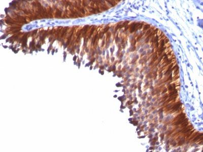 Cytokeratin 18 Monoclonal Mouse Antibody (KRT18/834)