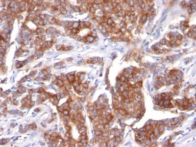 Cytokeratin 18 Monoclonal Mouse Antibody (KRT18/834)