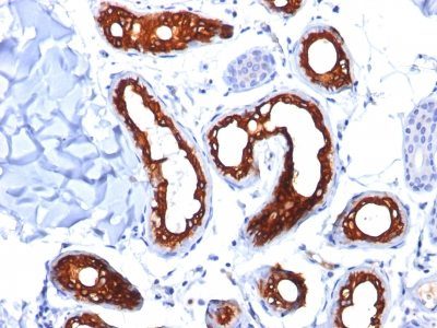Cytokeratin 18 Monoclonal Mouse Antibody (KRT18/834)