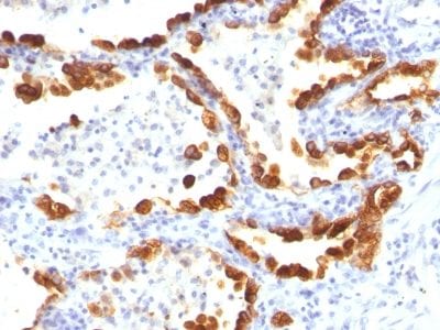 Cytokeratin 18 Monoclonal Mouse Antibody (KRT18/835)