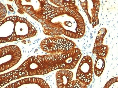 Cytokeratin 18 Monoclonal Mouse Antibody (KRT18/835)
