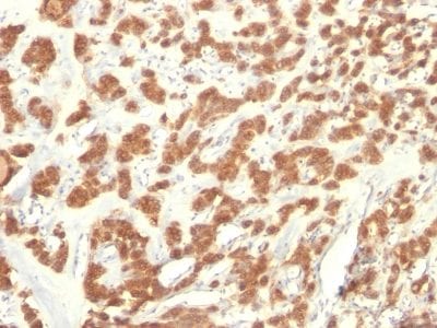 Cytokeratin 18 Monoclonal Mouse Antibody (KRT18/835)