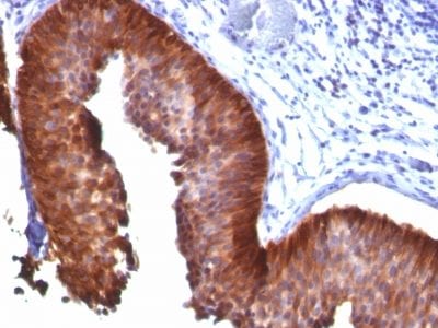 Cytokeratin 18 Monoclonal Mouse Antibody (KRT18/835)