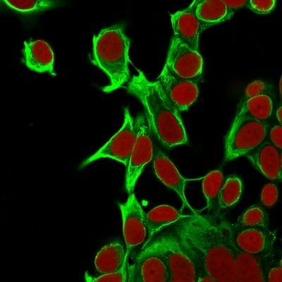 Cytokeratin 18 Monoclonal Mouse Antibody (KRT18/835)