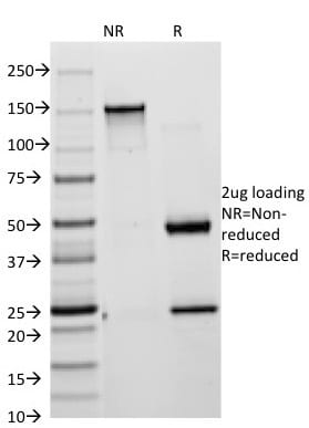 Cytokeratin 18 Monoclonal Mouse Antibody (KRT18/835)