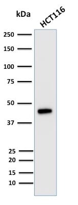 Cytokeratin 18 Monoclonal Mouse Antibody (KRT18/835)