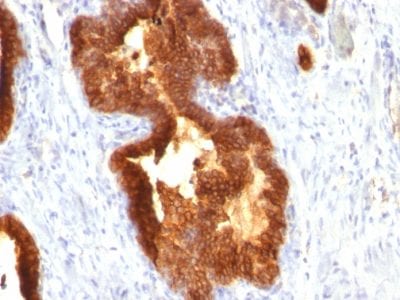 Cytokeratin 18 Monoclonal Mouse Antibody (KRT18/835)