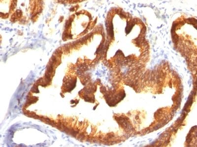 Cytokeratin 18 Monoclonal Mouse Antibody (KRT18/836)