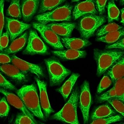 Cytokeratin 18 Monoclonal Mouse Antibody (KRT18/836)
