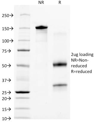 Cytokeratin 18 Monoclonal Mouse Antibody (KRT18/836)