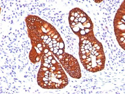 Cytokeratin 19 Monoclonal Mouse Antibody (A53-B/A2.26 + BA17)