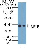 Cytokeratin 19 Monoclonal Mouse Antibody (A53-B/A2.26)