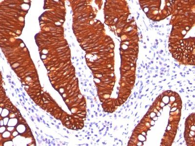 Cytokeratin 19 Monoclonal Mouse Antibody (A53-B/A2.26)