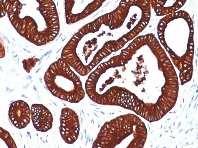 Cytokeratin 19 Monoclonal Mouse Antibody (BA17)