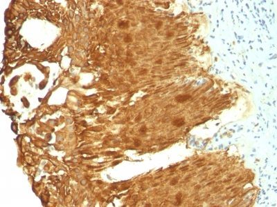 Cytokeratin 19 Monoclonal Mouse Antibody (KRT19/799 + KRT19/800)