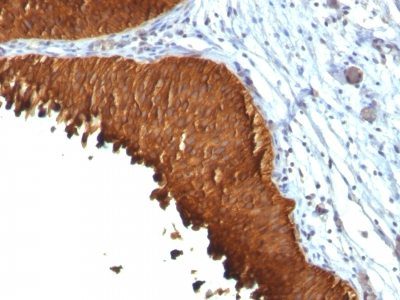 Cytokeratin 19 Monoclonal Mouse Antibody (KRT19/799 + KRT19/800)