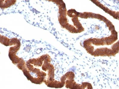 Cytokeratin 19 Monoclonal Mouse Antibody (KRT19/799 + KRT19/800)