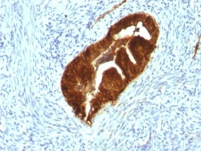 Cytokeratin 19 Monoclonal Mouse Antibody (KRT19/799 + KRT19/800)
