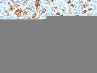 Cytokeratin 19 Monoclonal Mouse Antibody (KRT19/799 + KRT19/800)