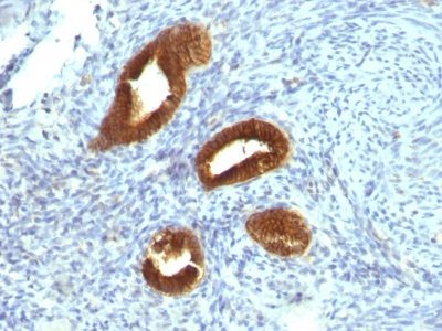 Cytokeratin 19 Monoclonal Mouse Antibody (KRT19/799)