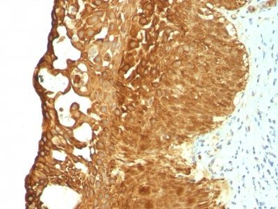 Cytokeratin 19 Monoclonal Mouse Antibody (KRT19/799)