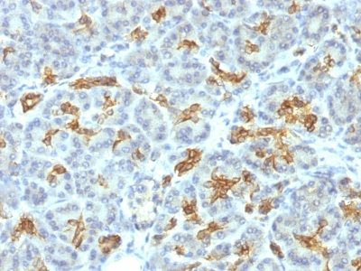 Cytokeratin 19 Monoclonal Mouse Antibody (KRT19/799)