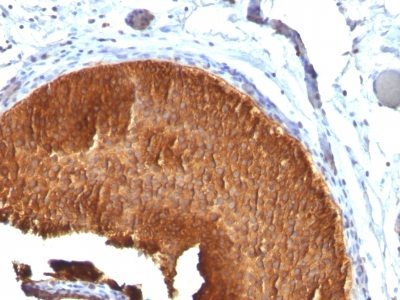 Cytokeratin 19 Monoclonal Mouse Antibody (KRT19/799)