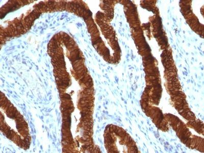 Cytokeratin 19 Monoclonal Mouse Antibody (KRT19/800)