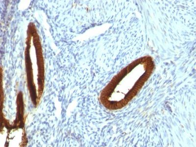 Cytokeratin 19 Monoclonal Mouse Antibody (KRT19/800)