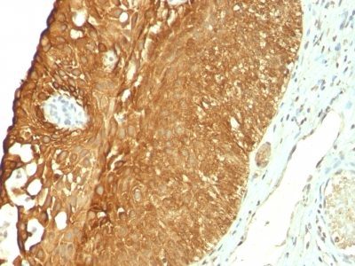 Cytokeratin 19 Monoclonal Mouse Antibody (KRT19/800)