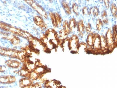 Cytokeratin 19 Monoclonal Mouse Antibody (KRT19/800)