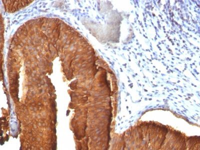 Cytokeratin 19 Monoclonal Mouse Antibody (KRT19/800)
