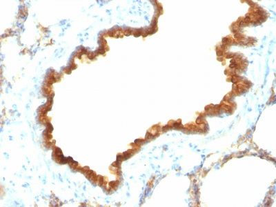 Cytokeratin 19 Monoclonal Mouse Antibody (KRT19/800)