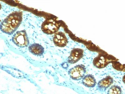 Cytokeratin 19 Monoclonal Mouse Antibody (KRT19/800)