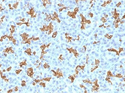 Cytokeratin 19 Monoclonal Mouse Antibody (KRT19/800)