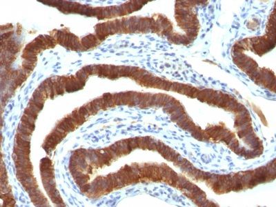 Cytokeratin 19 Monoclonal Mouse Antibody (Ks19.1)