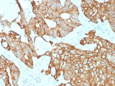 Cytokeratin 19 Recombinant Monoclonal Mouse Antibody (rKRT19/800)