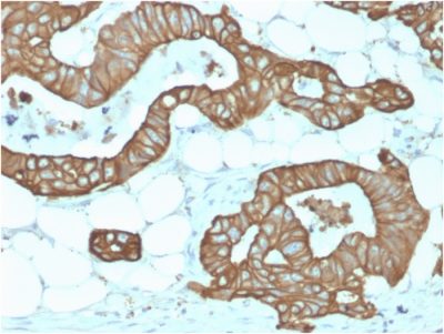 Cytokeratin 19 Recombinant Monoclonal Rabbit Antibody (KRT19/1959R)