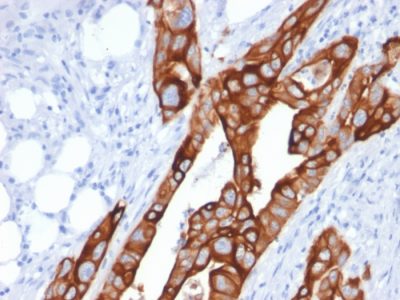 Cytokeratin 20 Monoclonal Mouse Antibody (KRT20/1991)