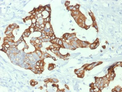 Cytokeratin 20 Monoclonal Mouse Antibody (KRT20/1992)