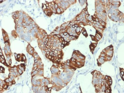 Cytokeratin 20 Monoclonal Mouse Antibody (KRT20/1993)