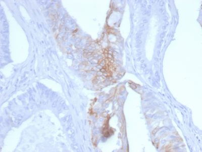 Cytokeratin 20 Monoclonal Mouse Antibody (KRT20/3145)