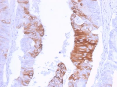 Cytokeratin 20 Recombinant Monoclonal Rabbit Antibody (KRT20/3129R)