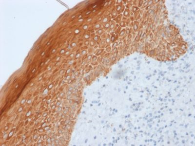 Cytokeratin 5/6/18 Monoclonal Mouse Antibody (LP34)