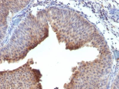 Cytokeratin 6 Monoclonal Mouse Antibody (LHK6)