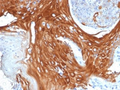 Cytokeratin 6A Monoclonal Mouse Antibody (KRT6A/2368)