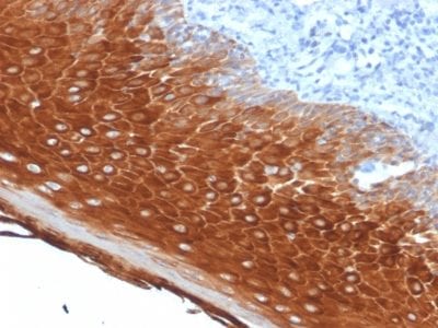 Cytokeratin 6A Monoclonal Mouse Antibody (KRT6A/2368)