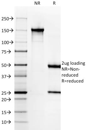 Cytokeratin 6A Monoclonal Mouse Antibody (KRT6A/2368)